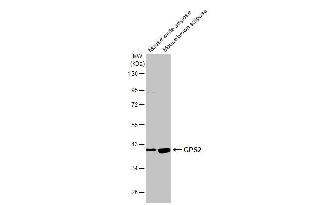 Various tissue extracts (30 μg) were separated by 10% SDS-PAGE, and the membrane was blotted with GPS2 antibody [HL2276] (GTX638329) diluted at 1:1000. The HRP-conjugated anti-rabbit IgG antibody (GTX213110-01) was used to detect the primary antibody.