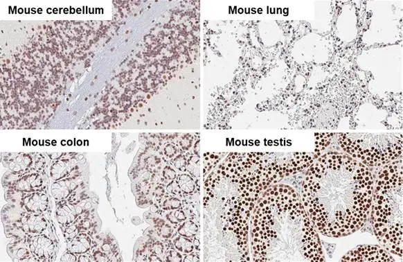 DNA ligase III antibody [HL2280] detects DNA ligase III protein by immunohistochemical analysis. Sample: Paraffin-embedded mouse tissues. DNA ligase III stained by DNA ligase III antibody [HL2280] (GTX638333) diluted at 1:100. Antigen Retrieval: Citrate buffer, pH 6.0, 15 min
