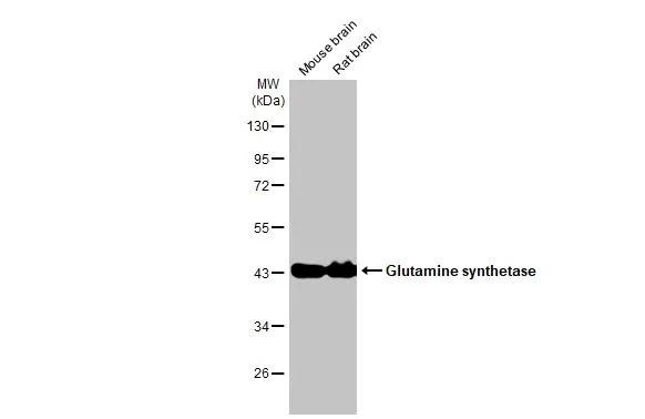 Various tissue extracts (50 μg) were separated by 10% SDS-PAGE, and the membrane was blotted with Glutamine synthetase antibody [HL2283] (GTX638336) diluted at 1:5000. The HRP-conjugated anti-rabbit IgG antibody (GTX213110-01) was used to detect the primary antibody.