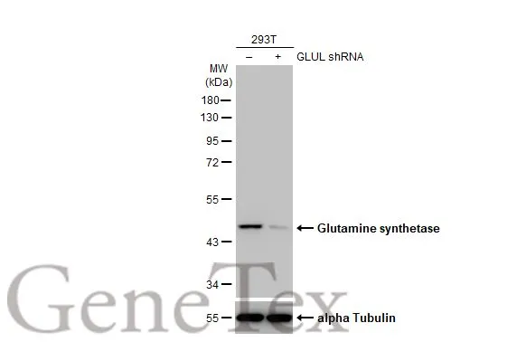 Non-transfected (–) and transfected (+) 293T whole cell extracts (30 μg) were separated by 10% SDS-PAGE, and the membrane was blotted with Glutamine synthetase antibody [HL2283] (GTX638336) diluted at 1:5000. The HRP-conjugated anti-rabbit IgG antibody (GTX213110-01) was used to detect the primary antibody.