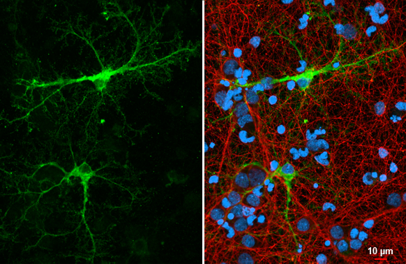 Glutamine synthetase antibody [HL2283] detects Glutamine synthetase protein at glia by immunofluorescent analysis. Sample: DIV9 rat E18 primary cortical neuron and glia cells were fixed in 4% paraformaldehyde at RT for 15 min. Green: Glutamine synthetase stained by Glutamine synthetase antibody [HL2283] (GTX638336) diluted at 1:250. Red: Tau, an axon marker, stained by Tau antibody [GT287] (GTX634809) diluted at 1:500. Blue: Fluoroshield with DAPI (GTX30920).