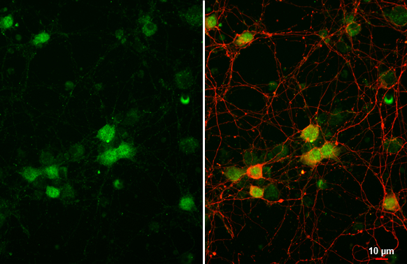 Brachyury antibody [HL2285] detects Brachyury protein at nucleus by immunofluorescent analysis. Sample: DIV9 rat E18 primary cortical neuron cells were fixed in 4% paraformaldehyde at RT for 15 min. Green: Brachyury stained by Brachyury antibody [HL2285] (GTX638338) diluted at 1:250. Red: Tau, an axon marker, stained by Tau antibody [GT287] (GTX634809) diluted at 1:500.