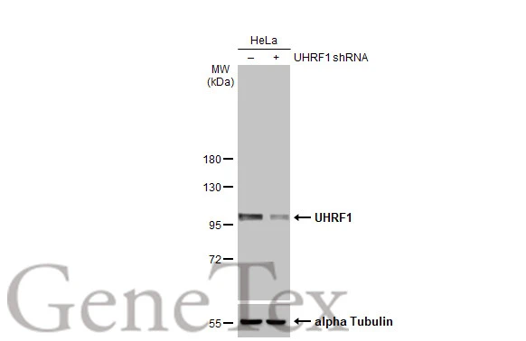 Non-transfected (–) and transfected (+) HeLa whole cell extracts (30 μg) were separated by 7.5% SDS-PAGE, and the membrane was blotted with UHRF1 antibody [HL2287] (GTX638342) diluted at 1:5000. The HRP-conjugated anti-rabbit IgG antibody (GTX213110-01) was used to detect the primary antibody.