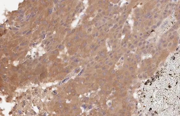 Anti-VEGFC antibody [HL2289] (GTX638344) | GeneTex