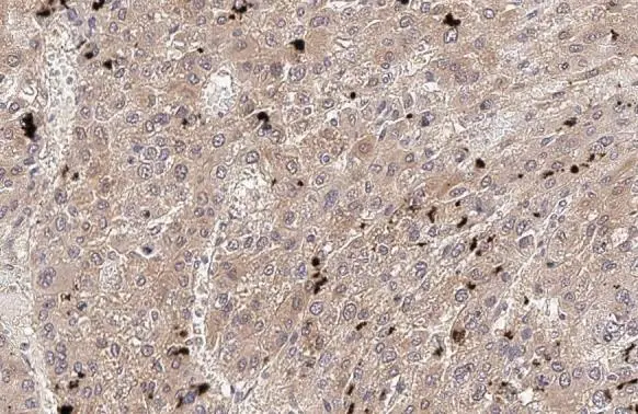 VEGFC antibody [HL2289]