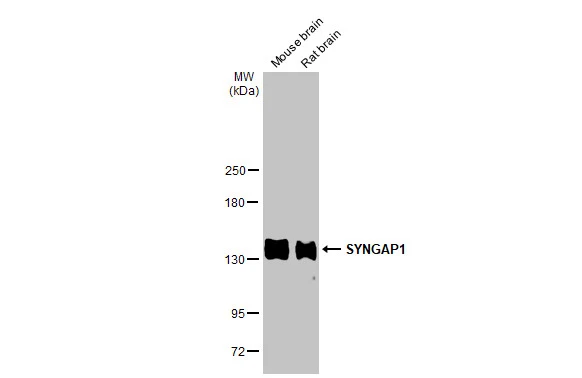 Various tissue extracts (50 μg) were separated by 5% SDS-PAGE, and the membrane was blotted with SYNGAP1 antibody [HL2292] (GTX638347) diluted at 1:1000. The HRP-conjugated anti-rabbit IgG antibody (GTX213110-01) was used to detect the primary antibody.
