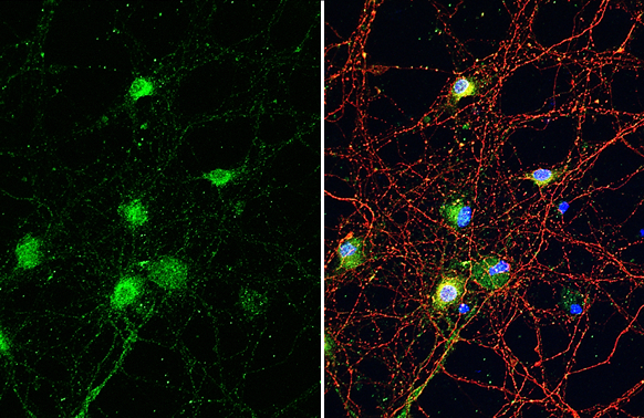 SYNGAP1 antibody [HL2292] detects SYNGAP1 protein at cytoplasm by immunofluorescent analysis. Sample: DIV9 rat E18 primary cortical neuron cells were fixed in 4% paraformaldehyde at RT for 15 min. Green: SYNGAP1 stained by SYNGAP1 antibody [HL2292] (GTX638347) diluted at 1:250. Red: Tau, an axon marker, stained by Tau antibody [GT287] (GTX634809) diluted at 1:500. Blue: Fluoroshield with DAPI (GTX30920).