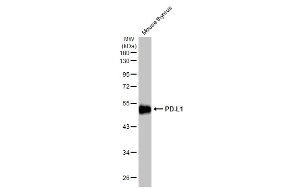 Anti-PD-L1 antibody [HL2293] (GTX638348) | GeneTex