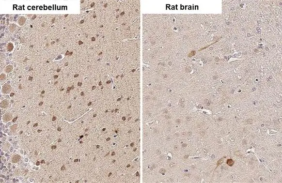 RNF31 antibody [HL2295] detects RNF31 protein by immunohistochemical analysis. Sample: Paraffin-embedded rat tissues. RNF31 stained by RNF31 antibody [HL2295] (GTX638350) diluted at 1:100. Antigen Retrieval: Citrate buffer, pH 6.0, 15 min