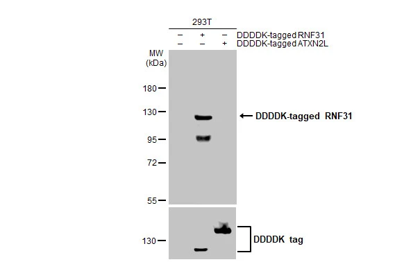 Non-transfected (–) and transfected (+) 293T whole cell extracts were separated by 7.5% SDS-PAGE, and the membrane was blotted with RNF31 antibody [HL2295] (GTX638350) diluted at 1:5000. The HRP-conjugated anti-rabbit IgG antibody (GTX213110-01) was used to detect the primary antibody.