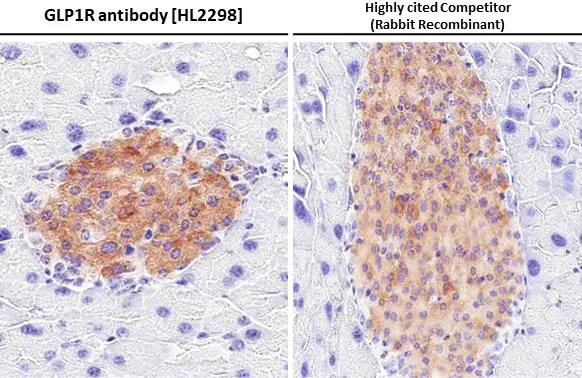 GLP1R antibody [HL2298] detects GLP1R protein at cell membrane and cytoplasm by immunohistochemical analysis. Sample: Paraffin-embedded mouse pancreas. GLP1R stained by GLP1R antibody [HL2298] (GTX638353) diluted at 1:2000 and competitor's antibody (ab218532) diluted at 1:2000. Antigen Retrieval: Citrate buffer, pH 6.0, 15 min *Competitor's antibody is not affiliated with GeneTex and does not endorse this product.