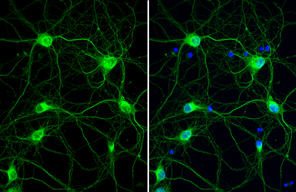 Cathepsin S antibody [HL2302] detects Cathepsin S protein at fiber by immunofluorescent analysis. Sample: DIV9 rat E18 primary cortical neuron cells were fixed in 4% paraformaldehyde at RT for 15 min. Green: Cathepsin S stained by Cathepsin S antibody [HL2302] (GTX638369) diluted at 1:250. Blue: Fluoroshield with DAPI (GTX30920).