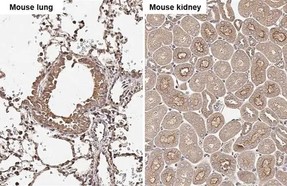 Cathepsin S antibody [HL2302] detects Cathepsin S protein by immunohistochemical analysis. Sample: Paraffin-embedded mouse tissues. Cathepsin S stained by Cathepsin S antibody [HL2302] (GTX638369) diluted at 1:100. Antigen Retrieval: Citrate buffer, pH 6.0, 15 min