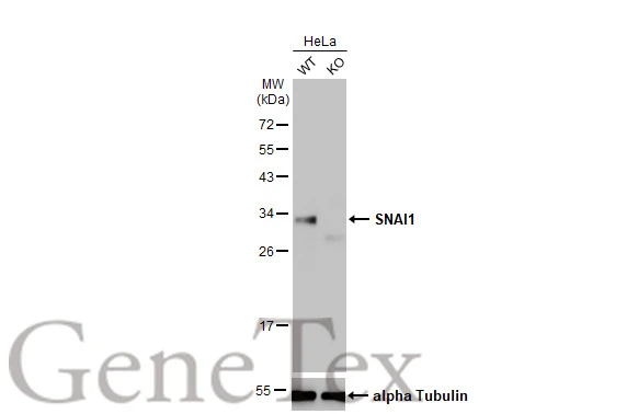 Wild-type (WT) and SNAI1 knockout (KO) HeLa cell extracts (30 μg) were separated by 12% SDS-PAGE, and the membrane was blotted with SNAI1 antibody [HL2303] (GTX638370) diluted at 1:1000. The HRP-conjugated anti-rabbit IgG antibody (GTX213110-01) was used to detect the primary antibody, and the signal was developed with Trident ECL plus-Enhanced.