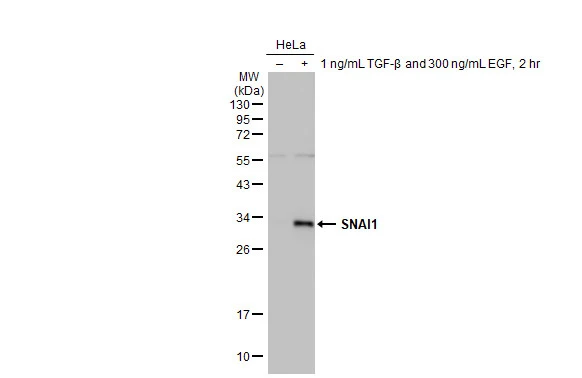 Untreated (–) and treated (+) HeLa whole cell extract (30 μg) were separated by 12% SDS-PAGE, and the membrane was blotted with SNAI1 antibody [HL2303] (GTX638370) diluted at 1:1000. The HRP-conjugated anti-rabbit IgG antibody (GTX213110-01) was used to detect the primary antibody.