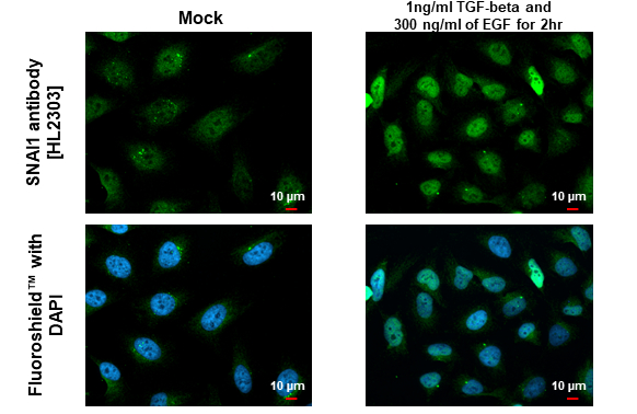 SNAI1 antibody [HL2303] detects SNAI1 protein at cytoplasm and nucleus by immunofluorescent analysis. Sample: Mock and treated HeLa cells were fixed in 4% paraformaldehyde at RT for 15 min. Green: SNAI1 stained by SNAI1 antibody [HL2303] (GTX638370) diluted at 1:1000. Blue: Fluoroshield with DAPI (GTX30920).