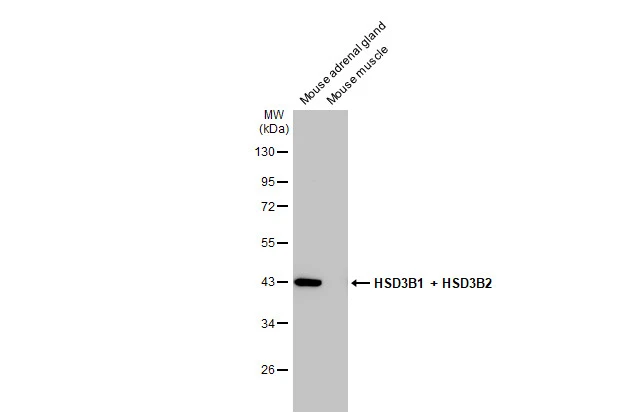 HSD3B1 + HSD3B2 antibody [HL2307]