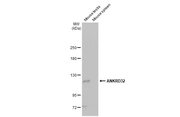 ANKRD32 antibody [HL2311]