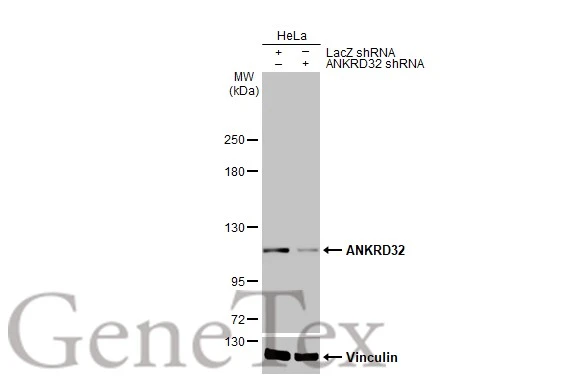 ANKRD32 antibody [HL2311]