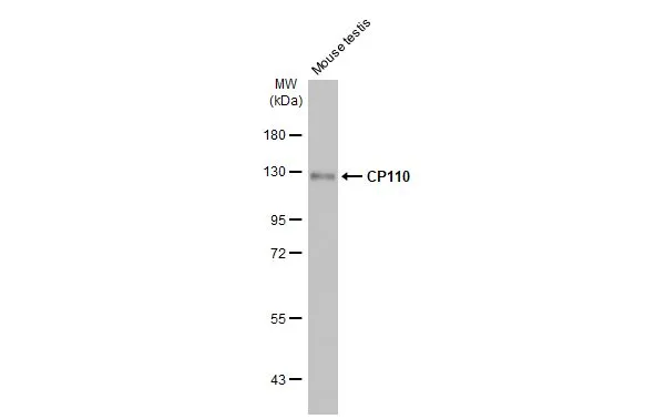 Mouse tissue extract (50 μg) was separated by 7.5% SDS-PAGE, and the membrane was blotted with CP110 antibody [HL2312] (GTX638475) diluted at 1:1000. The HRP-conjugated anti-rabbit IgG antibody (GTX213110-01) was used to detect the primary antibody.
