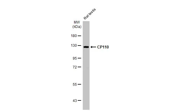 Rat tissue extract (50 μg) was separated by 7.5% SDS-PAGE, and the membrane was blotted with CP110 antibody [HL2312] (GTX638475) diluted at 1:1000. The HRP-conjugated anti-rabbit IgG antibody (GTX213110-01) was used to detect the primary antibody.