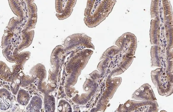 Anti-TLR3 antibody [HL2314] (GTX638477) | GeneTex