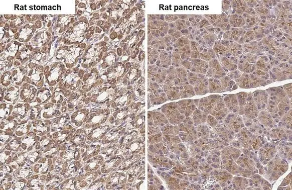 Anti-TLR3 antibody [HL2314] (GTX638477) | GeneTex