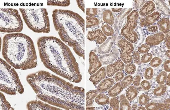 ST6GAL1 antibody [HL2318] detects ST6GAL1 protein by immunohistochemical analysis. Sample: Paraffin-embedded mouse tissues. ST6GAL1 stained by ST6GAL1 antibody [HL2318] (GTX638481) diluted at 1:100. Antigen Retrieval: Citrate buffer, pH 6.0, 15 min