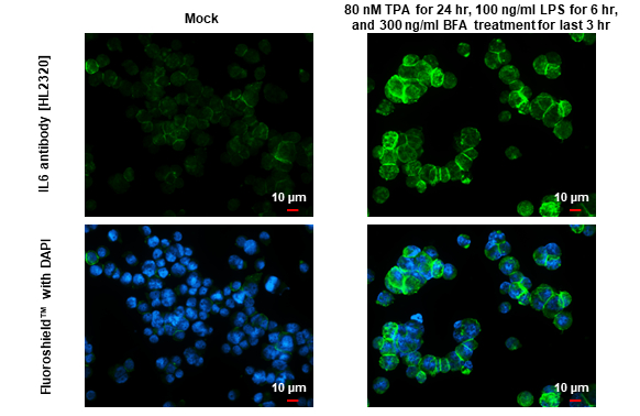 IL6 antibody [HL2320] detects IL6 protein by immunofluorescent analysis. Sample: Mock and treated THP-1 cells were fixed in ice-cold MeOH for 5 min. Green: IL6 stained by IL6 antibody [HL2320] (GTX638483) diluted at 1:100. Blue: Fluoroshield with DAPI (GTX30920).