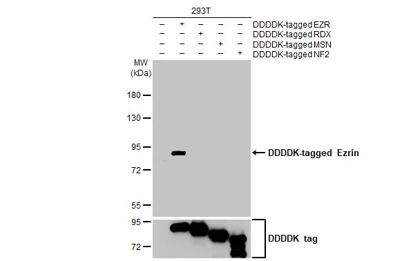 Non-transfected (–) and transfected (+) 293T whole cell extracts were separated by 7.5% SDS-PAGE, and the membrane was blotted with Ezrin antibody [HL2327] (GTX638490) diluted at 1:20000. The HRP-conjugated anti-rabbit IgG antibody (GTX213110-01) was used to detect the primary antibody.
