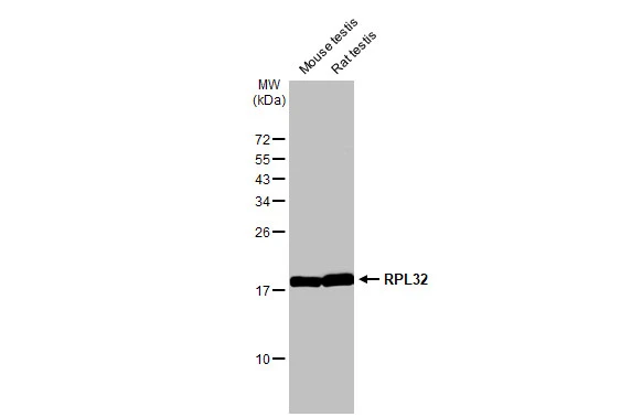 Various tissue extracts (50 μg) were separated by 15% SDS-PAGE, and the membrane was blotted with RPL32 antibody [HL2329] (GTX638492) diluted at 1:1000. The HRP-conjugated anti-rabbit IgG antibody (GTX213110-01) was used to detect the primary antibody.