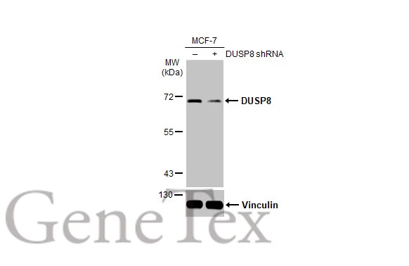 Non-transfected (–) and transfected (+) MCF-7 whole cell extracts (30 μg) were separated by 7.5% SDS-PAGE, and the membrane was blotted with DUSP8 antibody [HL2338] (GTX638541) diluted at 1:1000. The HRP-conjugated anti-rabbit IgG antibody (GTX213110-01) was used to detect the primary antibody.