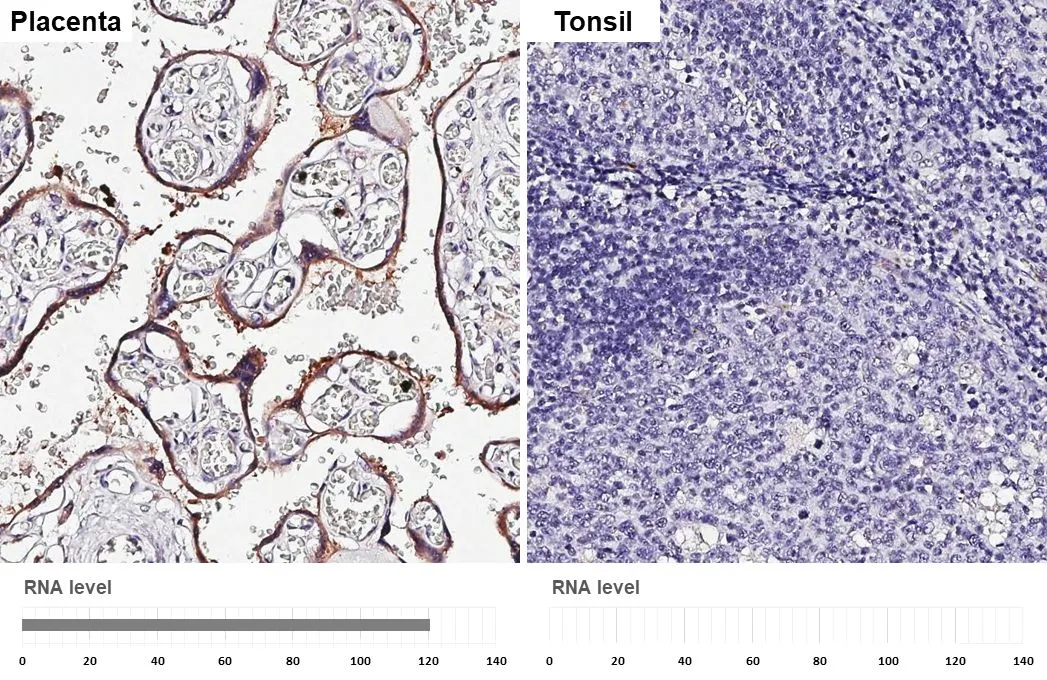 Aromatase antibody [HL2339] detects Aromatase protein by immunohistochemical analysis. Sample: Paraffin-embedded human tissues. Aromatase stained by Aromatase antibody [HL2339] (GTX638542) diluted at 1:4000. Antigen Retrieval: Citrate buffer, pH 6.0, 15 min