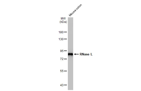 Mouse tissue extract (50 μg) was separated by 7.5% SDS-PAGE, and the membrane was blotted with RNase L antibody [HL2341] (GTX638544) diluted at 1:1000. The HRP-conjugated anti-rabbit IgG antibody (GTX213110-01) was used to detect the primary antibody.