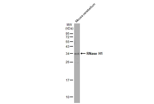 Mouse tissue extract (50 μg) was separated by 12% SDS-PAGE, and the membrane was blotted with RNase H1 antibody [HL2343] (GTX638546) diluted at 1:2000. The HRP-conjugated anti-rabbit IgG antibody (GTX213110-01) was used to detect the primary antibody.