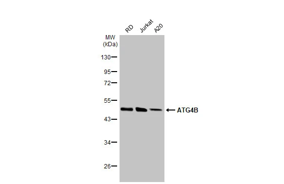 Various whole cell extracts (30 μg) were separated by 10% SDS-PAGE, and the membrane was blotted with ATG4B antibody [HL2348] (GTX638551) diluted at 1:5000. The HRP-conjugated anti-rabbit IgG antibody (GTX213110-01) was used to detect the primary antibody.