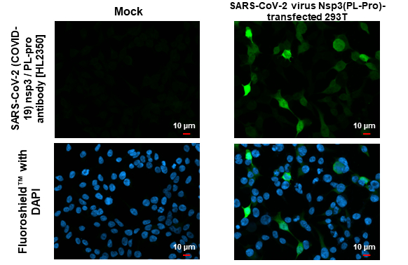 SARS-CoV-2 (COVID-19) nsp3 / PL-pro antibody [HL2350] detects SARS-CoV-2 (COVID-19) nsp3 / PL-pro protein by immunofluorescent analysis. Sample: Mock and transfected 293T cells were fixed in 4% paraformaldehyde at RT for 15 min. Green: SARS-CoV-2 (COVID-19) nsp3 / PL-pro stained by SARS-CoV-2 (COVID-19) nsp3 / PL-pro antibody [HL2350] (GTX638553) diluted at 1:500. Blue: Fluoroshield with DAPI (GTX30920).