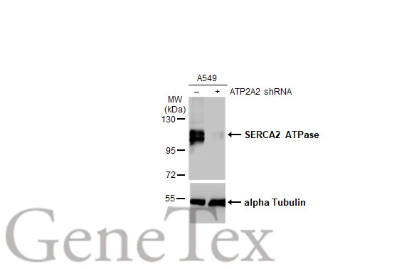Non-transfected (–) and transfected (+) A549 whole cell extracts (30 μg) were separated by 7.5% SDS-PAGE, and the membrane was blotted with SERCA2 ATPase antibody [HL2352] (GTX638555) diluted at 1:1000. The HRP-conjugated anti-rabbit IgG antibody (GTX213110-01) was used to detect the primary antibody.