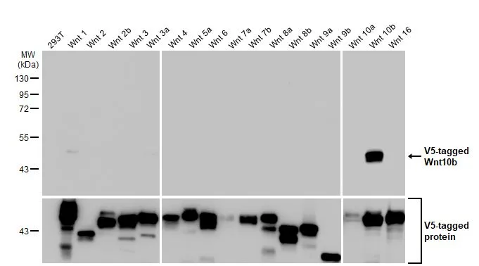 Non-transfected (–) and transfected (+) 293T whole cell extracts (30 μg) were separated by 10% SDS-PAGE, and the membrane was blotted with Wnt10b antibody [HL2370] (GTX638576) diluted at 1:5000. The HRP-conjugated anti-rabbit IgG antibody (GTX213110-01) was used to detect the primary antibody.