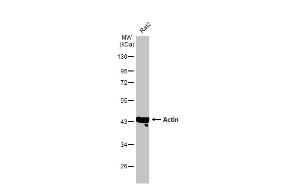 Whole cell extract (30 μg) was separated by 10% SDS-PAGE, and the membrane was blotted with Actin antibody [HL2372] (GTX638580) diluted at 1:50000. The HRP-conjugated anti-rabbit IgG antibody (GTX213110-01) was used to detect the primary antibody.