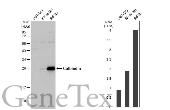 Calbindin antibody [HL2378]