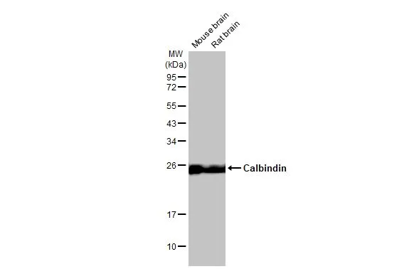 Calbindin antibody [HL2378]