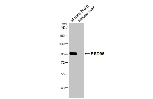 Various tissue extracts (50 μg) were separated by 7.5% SDS-PAGE, and the membrane was blotted with PSD95 antibody [HL2382] (GTX638590) diluted at 1:1000. The HRP-conjugated anti-rabbit IgG antibody (GTX213110-01) was used to detect the primary antibody.