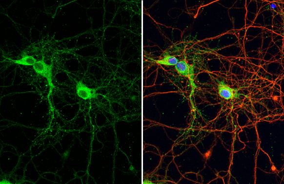 PSD95 antibody [HL2382] detects PSD95 protein at synapse by immunofluorescent analysis. Sample: DIV9 rat E18 primary hippocampal neuron cells were fixed in 4% paraformaldehyde at RT for 15 min. Green: PSD95 stained by PSD95 antibody [HL2382] (GTX638590) diluted at 1:250. Red: Tau, an axon marker, stained by Tau antibody [GT287] (GTX634809) diluted at 1:500. Blue: Fluoroshield with DAPI (GTX30920).