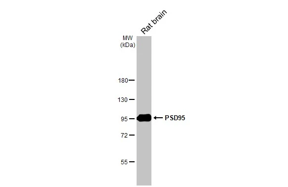 Rat tissue extract (50 μg) was separated by 7.5% SDS-PAGE, and the membrane was blotted with PSD95 antibody [HL2382] (GTX638590) diluted at 1:1000. The HRP-conjugated anti-rabbit IgG antibody (GTX213110-01) was used to detect the primary antibody.