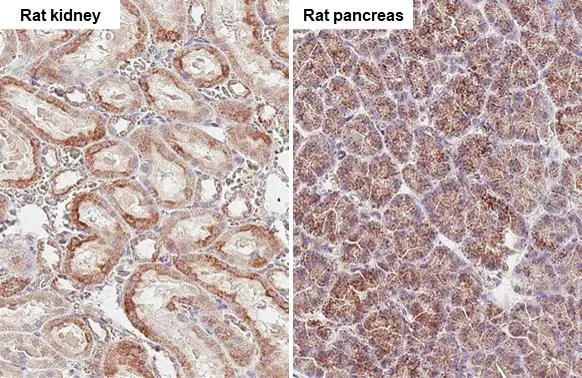 SUCLG1 antibody [HL2387] detects SUCLG1 protein at mitochondria by immunohistochemical analysis. Sample: Paraffin-embedded rat tissue. SUCLG1 stained by SUCLG1 antibody [HL2387] (GTX638596) diluted at 1:100. Antigen Retrieval: Citrate buffer, pH 6.0, 15 min