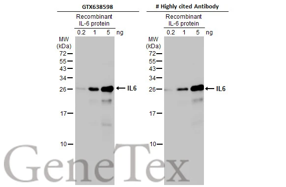 Recombinant IL6 were separated by 15% SDS-PAGE, and the membranes were blotted with IL6 antibody [HL2389] (GTX638598) diluted at 1:1000 and competitor's antibody diluted at 1:1000. The HRP-conjugated anti-rabbit IgG antibody (GTX213110-01) was used to detect the primary antibody. *The competitor is not affiliated with GeneTex and does not endorse this product.