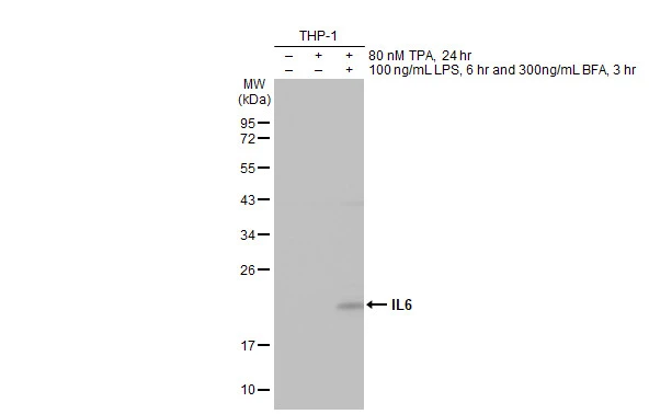 Untreated (–) and treated (+) THP-1 whole cell extracts (30 μg) were separated by 12% SDS-PAGE, and the membrane was blotted with IL6 antibody [HL2389] (GTX638598) diluted at 1:1000. The HRP-conjugated anti-rabbit IgG antibody (GTX213110-01) was used to detect the primary antibody, and the signal was developed with Trident ECL plus-Enhanced.