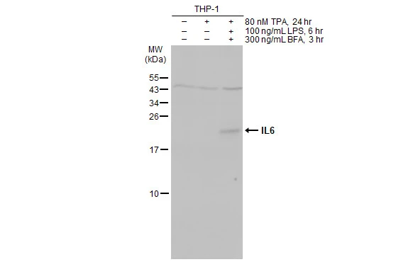 Untreated (–) and treated (+) THP-1 whole cell extract (30 μg) were separated by 15% SDS-PAGE, and the membrane was blotted with IL6 antibody [HL2389] (GTX638598) diluted at 1:500. The HRP-conjugated anti-rabbit IgG antibody (GTX213110-01) was used to detect the primary antibody, and the signal was developed with Trident ECL plus-Enhanced.