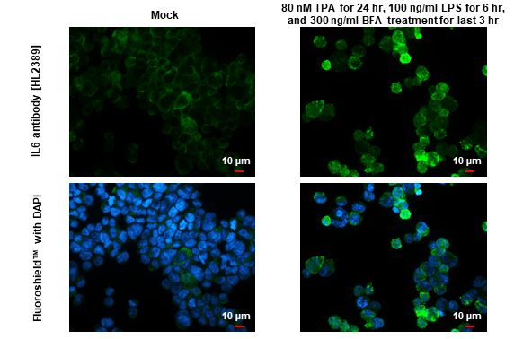IL6 antibody [HL2389] detects IL6 protein by immunofluorescent analysis. Sample: Mock and treated THP-1 cells were fixed in 4% paraformaldehyde at RT for 15 min. Green: IL6 stained by IL6 antibody [HL2389] (GTX638598) diluted at 1:100. Blue: Fluoroshield with DAPI (GTX30920).